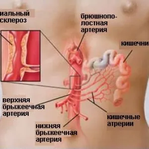 Cât de periculos tromboză