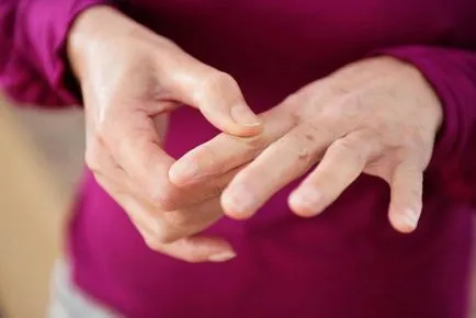 Itch între degete cauze posibile și tratamentul prurit