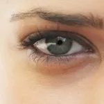 Ce se întâmplă dacă umflatura din jurul ochilor si pungile de sub ochi - rețete pentru frumusețe și sănătate (ochi) Ce se întâmplă dacă umflatura din jurul ochilor si pungile de sub ochi - rețete pentru sănătate și frumusețe