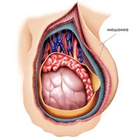 Prostatita care a tratat Prostatita care a tratat