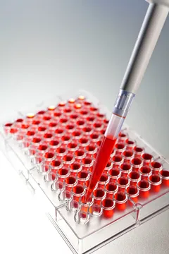 Aceasta arată rata parametrilor biochimici analiza sângelui, decodarea și analiza prețurilor (chimia sângelui) Aceasta arată rata parametrilor biochimici analiza sângelui, decodarea și analiza prețurilor