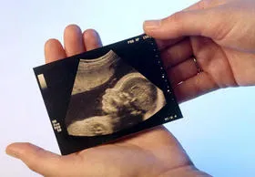 Ce este un Doppler fetale, procedura de performanță, rata, decodare, preturi