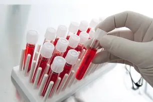 Aceasta arată analiza biochimice