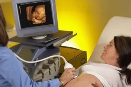 Ce este un Doppler fetale, procedura de performanță, rata, decodare, preturi