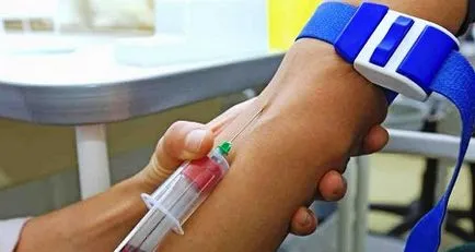 D-dimer în timpul sarcinii - rata de analiză, motivele creșterii (normal) D-dimer în timpul sarcinii - rata de analiză, motivele creșterii