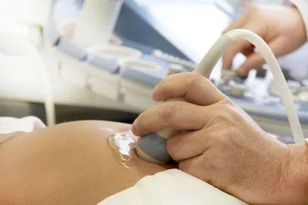 Parametrii Doppler fetal de decriptare în timpul sarcinii, standardele de ultrasunete