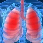 Tratamentul eficient al acasă căi de atac tuse (copii de tratament specificitate) Tratamentul eficient al acasă căi de atac tuse