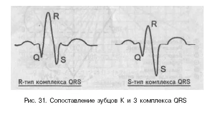 Axa electrice cardiace electrice și poziția (ventriculii vector de excitație) Axa electrică și poziția inimii electrice