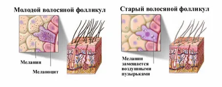 remedii populare eficiente pentru păr cărunt (bărbați andrologie de sănătate) remedii populare eficiente pentru părul gri