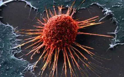 Renumitul medic oncolog a șocat lumea, principalul motiv de asteptare pentru dezvoltarea cancerului (care este foarte pasionat de) Renumitul medic oncolog a șocat lumea, principalul motiv de asteptare pentru dezvoltarea cancerului