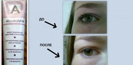 Cum sa scapi de pistrui