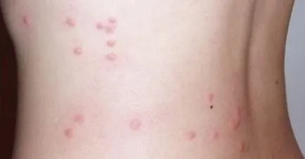 Cum sa scapi de purici în casa sau un apartament effektrivnye metodele de luptă (puricilor) Cum sa scapi de purici in casa sau un apartament effektrivnye modalitati de a combate