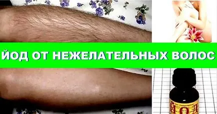 Cum sa scapi de parul de pe corp la domiciliu