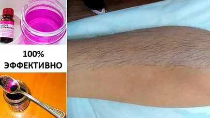 Cum sa scapi de parul de pe corp la domiciliu