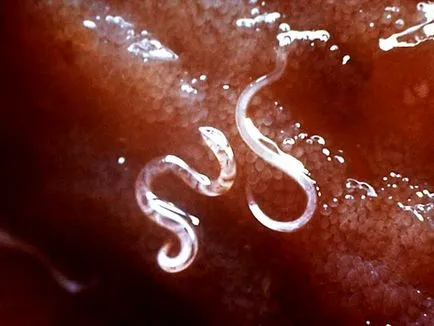 Cum de a trata giardia, instrucțiuni pas cu pas, rețete populare