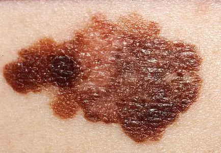 Cum moli (medicament)
