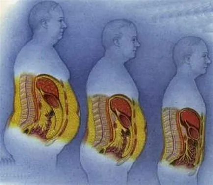 Deoarece procesul de ardere a grasimilor din organism