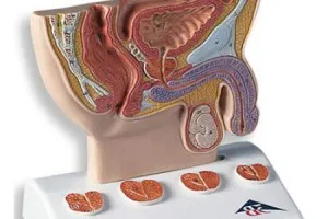 Prostatita care a tratat Prostatita care a tratat