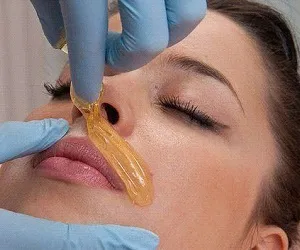 Cum de a elimina parul facial permanent la domiciliu cele mai eficiente metode (feței) Cum de a elimina parul facial permanent la domiciliu cele mai eficiente metode