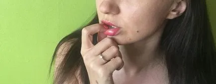 Ce mănâncă buza inferioară, la diferite momente ale zilei