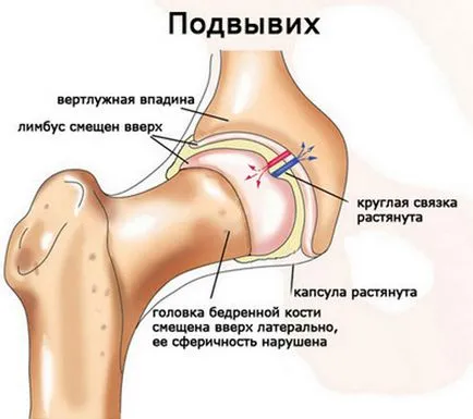 Ketonal „comentarii, instrucțiuni de utilizare, prețul de lumânări