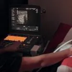 Când se administrează ganglionilor limfatici Uzi gatului Când se administrează ganglionilor limfatici Uzi gatului