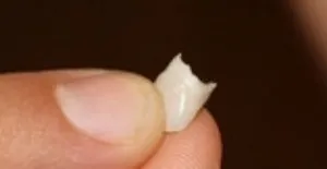 În cazul în care dintii de lapte cad în diagrama de copii, probleme și consiliere pentru părinți (atunci când un copil intră dinți de lapte) În cazul în care dinții copii cad în copil diagrama, provocările și sfaturi pentru părinți