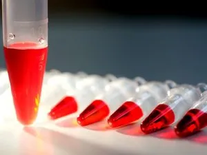 creatininei din sânge la femei și rata indicelui de diagnostic (creatinină în sânge) creatininei din sânge la femei, iar rata indicatorului diagnostic