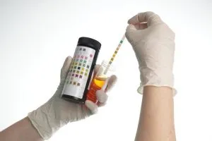 Sânge în urină de cauze de femei (motive) Sânge în urină de cauze pentru femei