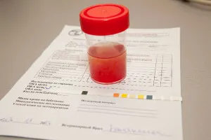 Sânge în urină de cauze pentru femei Sânge în urină de cauze pentru femei