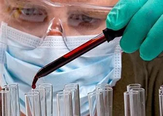 tipuri de analize de laborator, comportament, scop