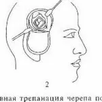 Melanina, care este - produse crește producția de melanină, ajutor și sfaturi (melanina) Melanina, care este - produse crește producția de melanină, ajutor și sfaturi