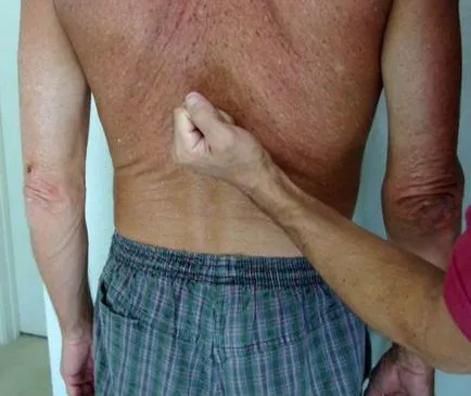 Urina cu sange la barbati, cauzele de descărcare de gestiune fără durere și cheaguri de sânge (bărbați) Urina cu sange la barbati, cauzele de descărcare de gestiune fără durere și cheaguri de sânge