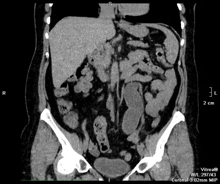 RMN-ul de formare abdominale pentru cercetare și cursul procedurii (cavitate) formare mri abdominale pentru cercetare și cursul procedurii