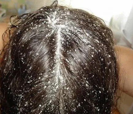 A se vedea cât de mult parul creste rata de luna trecută a creșterii, care determină rata de regenerare, și modul în care