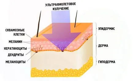 Corp mai multe cauze de birthmarks, tipuri de nevus, atunci când pentru a merge la medic, fotografie