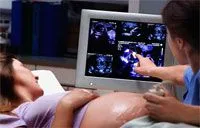 Determinarea sexul copilului pe ritmul cardiac Determinarea sexul copilului pe ritmul cardiac