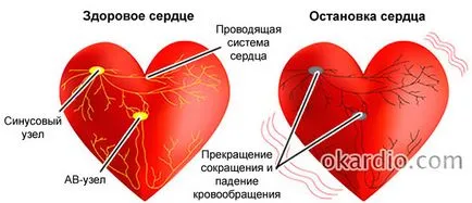 Insuficienta cardiaca cauze, simptome, de prim ajutor și prognoza