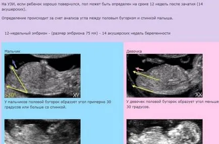 Se determină sexul bătăilor inimii copilului timp de 12 săptămâni - pentru a determina ce inimii fetale,