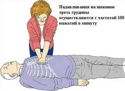 stop cardiac - cauze, simptome și tratament
