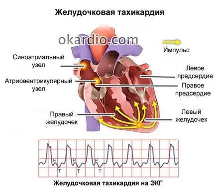 Insuficienta cardiaca cauze, simptome, de prim ajutor și prognoza