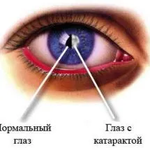 Răspunsul la întrebarea cum să-l trateze!
