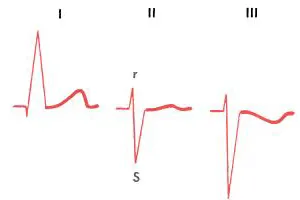 Deviația Axis (EOS)