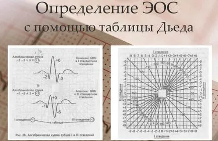 Abaterea axa din stânga diagnostic tactica