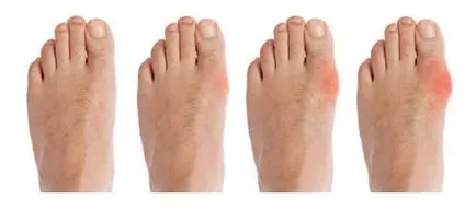 De ce picioare doare cauza dureri în partea dreaptă și piciorul stâng