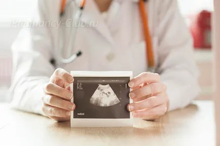 Lotsiruetsja ou fertilizat nu este ceea ce înseamnă, ovulul fertilizat