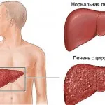 De ce este un om rece, în mod constant picioare reci, de ce o persoană pe mâini reci, nas rece