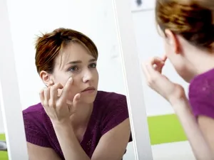 De ce ochii au început să se umfle, și ce să facă cauzele umflarea unui ochi, și eliminarea de edem