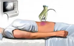 pancreas