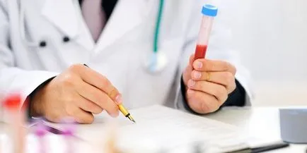Creșterea valorii creatininei în sânge ce înseamnă, cum de a reduce (creatinină) Creșterea valorii creatininei în sânge ce înseamnă, cum de a reduce